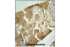 anti-Cyclin-Dependent Kinase Inhibitor 2C (p18, Inhibits CDK4) (CDKN2C) (AA 113-139), (C-Term) antibody