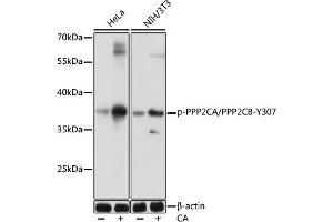 Western blot analysis of extracts of various cells, using Phospho-PPP2CA/PPP2CB-Y307 antibody (ABIN7269685) at 1:1000 dilution. (PPP2CB antibody  (pTyr307))