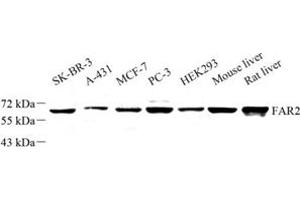 Western blot analysis of FAR2 (ABIN7073924) at dilution of 1: 500 (FAR2 antibody)