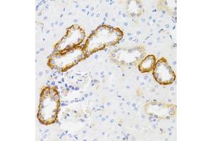 Immunohistochemistry of paraffin-embedded rat kidney using MYO5A antibody. (MYO5A antibody)