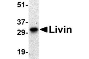 Western Blotting (WB) image for anti-Baculoviral IAP Repeat-Containing 7 (BIRC7) antibody (ABIN1031705) (BIRC7 antibody)