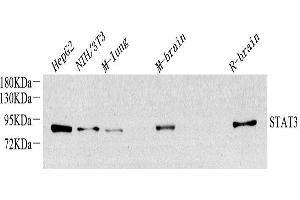 Western Blot analysis of various samples using STAT3 Monoclonal Antibody at dilution of 1:1500. (STAT3 antibody)