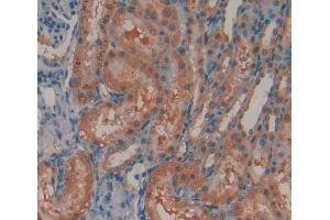 IHC-P analysis of Rat Tissue, with DAB staining. (N-Acetyl alpha-D-Glucosaminidase (AA 449-709) antibody)