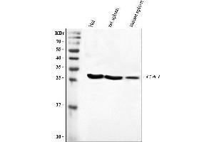 Western blot analysis of CA1 using anti-CA1 antibody (ABIN3043766). (CA1 antibody  (AA 9-261))