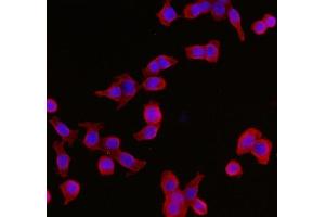 IF analysis of YWHAE using anti-YWHAE antibody (ABIN7599165). (YWHAE antibody  (AA 1-255))