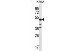 Western Blotting (WB) image for anti-Proline-serine-threonine Phosphatase Interacting Protein 1 (PSTPIP1) antibody (ABIN2996784) (PSTPIP1 antibody)