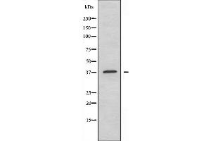 Western blot analysis of extracts from HepG2 cells using EFNA3 antibody.