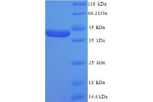 SDS-PAGE (SDS) image for Potassium Inwardly-Rectifying Channel, Subfamily J, Member 10 (KCNJ10) (AA 165-379), (Cytoplasmic Domain), (Cytosolic) protein (His-SUMO Tag) (ABIN5709795)
