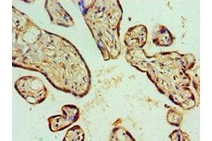 Immunohistochemistry of paraffin-embedded human placenta tissue using ABIN7143157 at dilution of 1:100 (ASCC3 antibody  (AA 1-111))