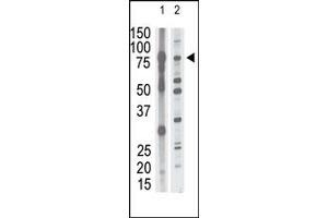Western Blotting (WB) image for anti-Matrix Metallopeptidase 15 (Membrane-inserted) (MMP15) (N-Term) antibody (ABIN358688) (MMP15 antibody  (N-Term))