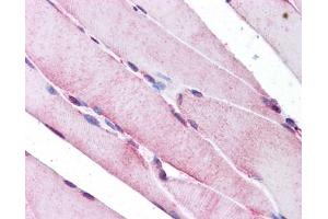 Immunohistochemistry (IHC) image for anti-Selenoprotein N, 1 (SEPN1) (C-Term) antibody (ABIN2773903) (SEPN1 antibody  (C-Term))