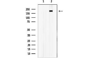 Western blot analysis of lysates from mouse brain, using ALPK2 Antibody.