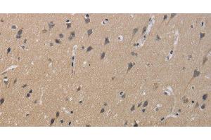 Immunohistochemistry of paraffin-embedded Human brain using KCNMB4 Polyclonal Antibody at dilution of 1:40 (KCNMB4 antibody)