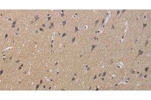 Immunohistochemistry of paraffin-embedded Human brain using KCNMB4 Polyclonal Antibody at dilution of 1:40