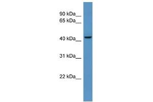 Western Blotting (WB) image for anti-UDP-Gal:betaGlcNAc beta 1,4-Galactosyltransferase, Polypeptide 6 (B4GALT6) (C-Term) antibody (ABIN2782655)