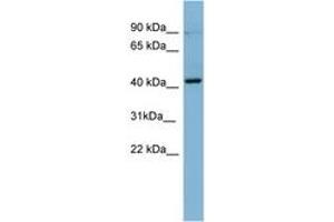 Image no. 1 for anti-Protein Kinase C, beta (PRKCB) (AA 71-120) antibody (ABIN6741698) (PKC beta antibody  (AA 71-120))