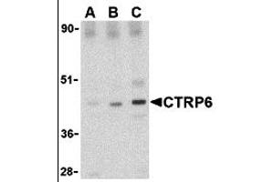 Western Blotting (WB) image for anti-Complement C1q Tumor Necrosis Factor-Related Protein 6 (C1QTNF6) (Middle Region) antibody (ABIN1030915) (CTRP6 antibody  (Middle Region))