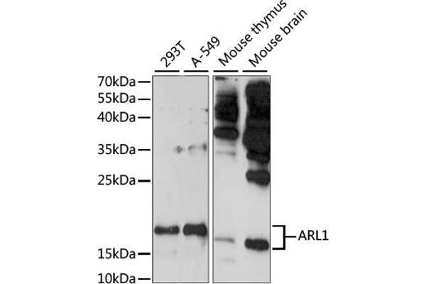 ARL1 抗体  (AA 62-181)