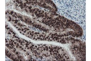 Image no. 5 for anti-TP53RK Binding Protein (TPRKB) antibody (ABIN1501484)