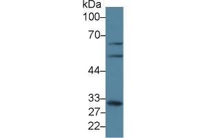 Western Blot; Sample: Human A431 cell lysate; Primary Ab: 5µg/ml Rabbit Anti-Human GCLM Antibody Second Ab: 0. (GCLM antibody  (AA 40-251))