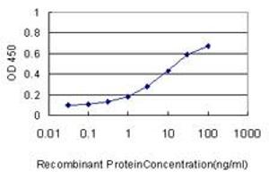 Detection limit for recombinant GST tagged MTUS1 is approximately 0. (MTUS1 antibody  (AA 1-240))