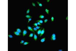 Immunofluorescent analysis of Hela cells using ABIN7142079 at dilution of 1:100 and Alexa Fluor 488-congugated AffiniPure Goat Anti-Rabbit IgG(H+L) (PHPT1 antibody  (AA 1-125))