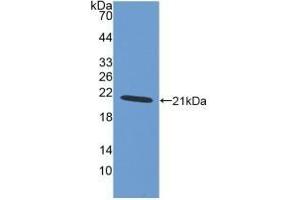 Detection of Recombinant AIF1, Human using Polyclonal Antibody to Ionized Calcium-binding Adapter Molecule 1 (IBA1) (Iba1 antibody  (AA 1-147))