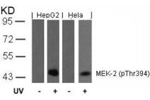 Image no. 2 for anti-Mitogen-Activated Protein Kinase Kinase 2 (MAP2K2) (pThr394) antibody (ABIN196623) (MEK2 antibody  (pThr394))
