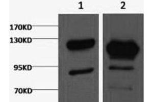 Western Blot analysis of 1) Jurkat, 2) Hela cells using Cleaved PARP1 Monoclonal Antibody at dilution of 1:2000. (PARP1 antibody  (cleaved))