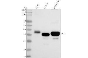 Western blot analysis of ARG1 using anti-ARG1 antibody (ABIN7604034).