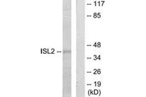 Western blot analysis of extracts from 293 cells, using ISL2 Antibody.