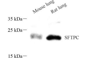 Western blot analysis of sftpc (ABIN7075216),at dilution of 1: 600 (Prosurfactant Protein C antibody)