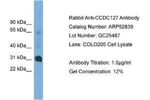 WB Suggested Anti-CCDC127  Antibody Titration: 0. (CCDC127 antibody  (N-Term))