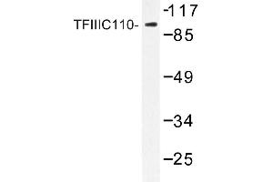 Image no. 1 for anti-General Transcription Factor IIIC, Polypeptide 2, beta 110kDa (GTF3C2) antibody (ABIN272244)