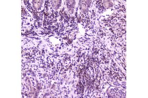 IHC analysis of PLCG 2 using anti-PLCG 2 antibody . (Phospholipase C gamma 2 antibody  (AA 1201-1258))