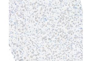 Immunohistochemistry (IHC) image for anti-Structural Maintenance of Chromosomes 1A (SMC1A) (C-Term) antibody (ABIN7455193) (Recombinant SMC1A antibody  (C-Term))
