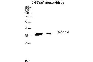 Western Blot (WB) analysis of SH-SY5Y Mouse Kidney lysis using GPR119 antibody. (G Protein-Coupled Receptor 119 antibody  (Internal Region))