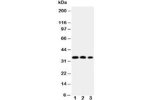 Western blot testing of HOXA4 antibody and Lane 1:  SW620;  2: SW620;  3: PC-12 cell Nuclear lysate