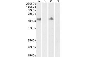(ABIN185563) (2 μg/mL) staining of Human Lymph node (A) + peptide (B) and Tonsil (C) + peptide (D) lysate (35 μg protein in RIPA buffer) Detected by chemiluminescence. (CD14 antibody  (Internal Region))