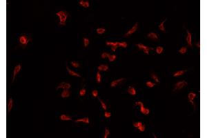 ABIN6266916 staining A549 cells by IF/ICC. (TNFAIP2 antibody)