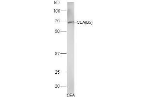 CEA antibody