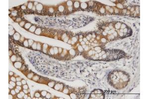 Immunoperoxidase of monoclonal antibody to TLR4 on formalin-fixed paraffin-embedded human small Intestine. (TLR4 antibody  (AA 214-291))