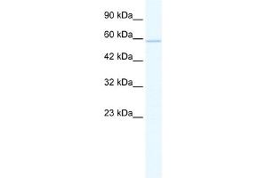 WB Suggested Anti-ZNF276 Antibody Titration:  1. (ZNF276 antibody  (Middle Region))