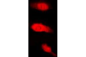 Immunofluorescent analysis of HuB staining in K562 cells. (HuB (Center) antibody)