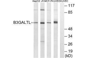 Western blot analysis of extracts from HepG2 cells, Jurkat cells, MCF-7 cells and HUVEC cells, using B3GALTL antibody. (B3GALTL antibody  (C-Term))