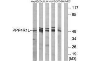 Western blot analysis of extracts from COLO/HuvEc/HepG2/Jurkat/COS cells, using PPP4R1L Antibody. (PPP4R1L antibody  (AA 191-240))