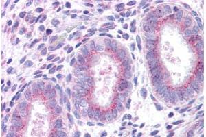 Human Uterus: Formalin-Fixed, Paraffin-Embedded (FFPE) (XCR1 antibody  (C-Term))