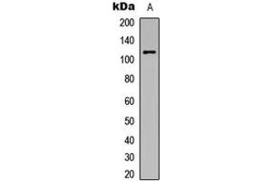 Western blot analysis of PKC mu (pY463) expression in HeLa (A) whole cell lysates. (PKC mu antibody  (pTyr463))
