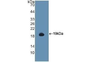 Detection of Recombinant GCSFR, Human using Polyclonal Antibody to Colony Stimulating Factor Receptor, Granulocyte (GCSFR) (CSF3R antibody  (AA 271-428))