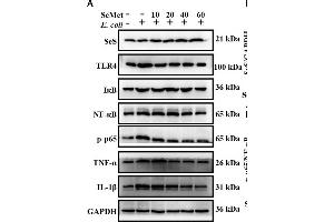 SeMet reversed activation of TLR4/NF-κB pathway induced by ESBL-E. (NF-kB p65 antibody  (pSer536))